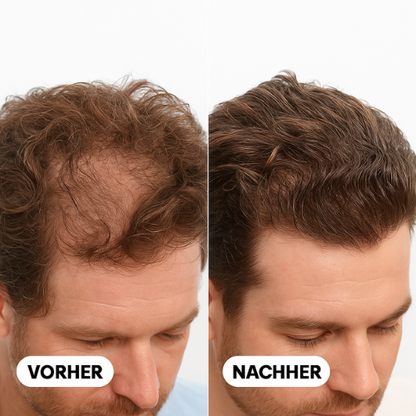 Wohlwuchs® - Spartan Root Activator Shampoo