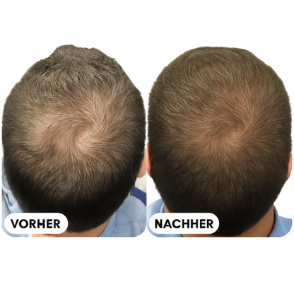 Wohlwuchs® - Spartan Root Activator Shampoo